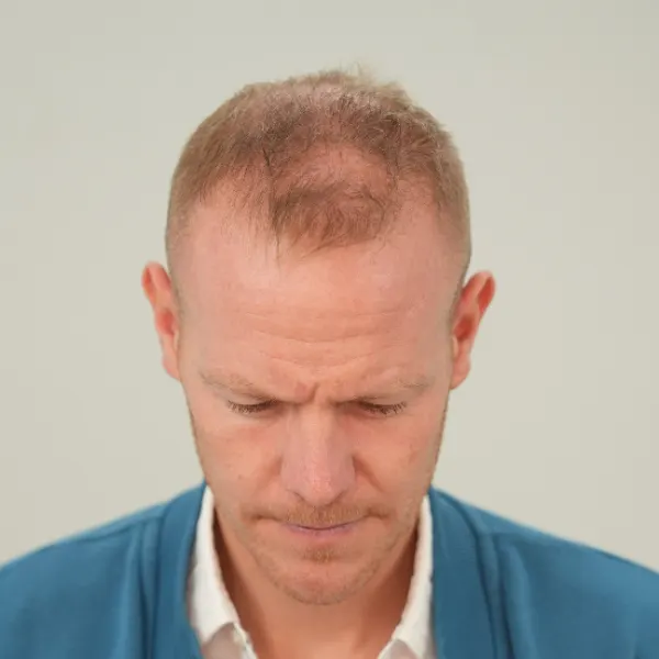 Tom Beugelsdijk voor de behandeling