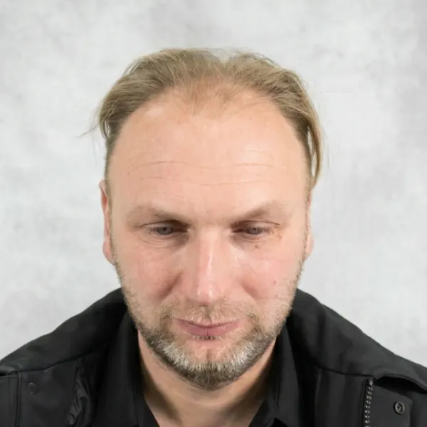 Steven Van Den Tillaart voor de behandeling