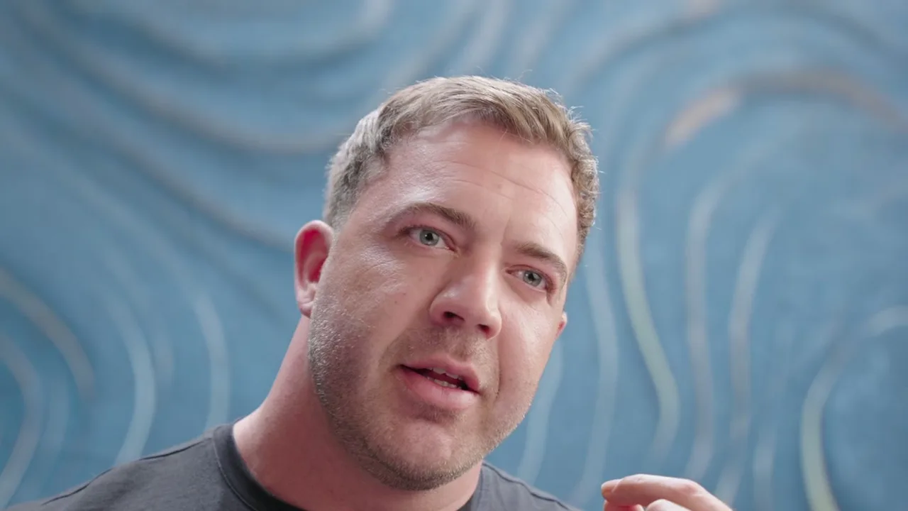 Bas Doeven, Haartransplantatie